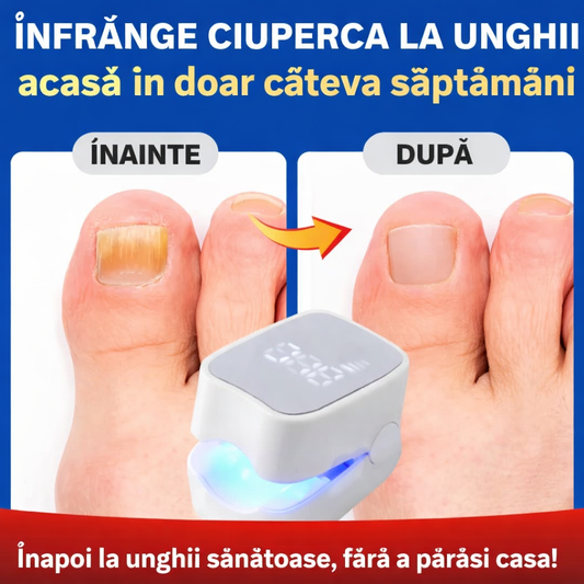 Dispozitiv cu laser pentru tratarea ciupercii unghiilor – elimină cauza fungică, acasă