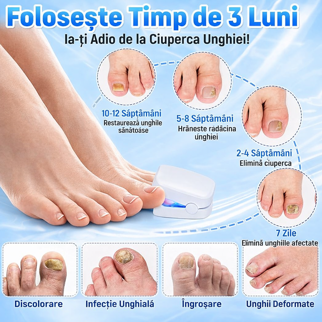 Dispozitiv cu laser pentru tratarea ciupercii unghiilor – elimină cauza fungică, acasă