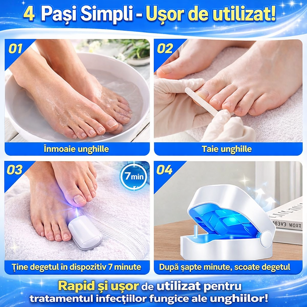 Dispozitiv cu laser pentru tratarea ciupercii unghiilor – elimină cauza fungică, acasă